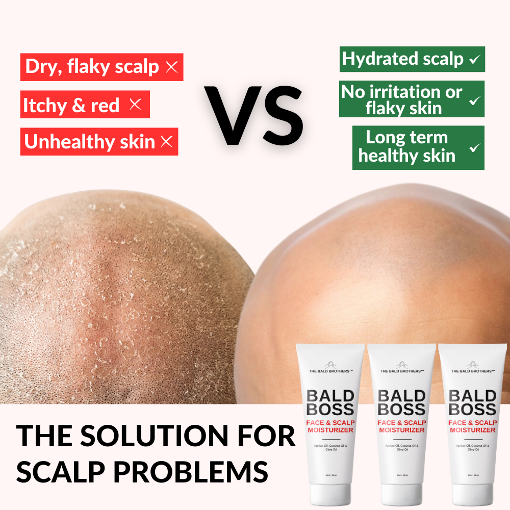 Bald Boss | 90ml Mattifying Bald Head Moisturiser
