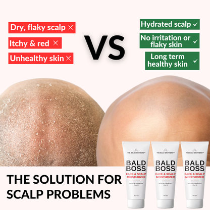 Bald Boss | 90ml Mattifying Bald Head Moisturiser