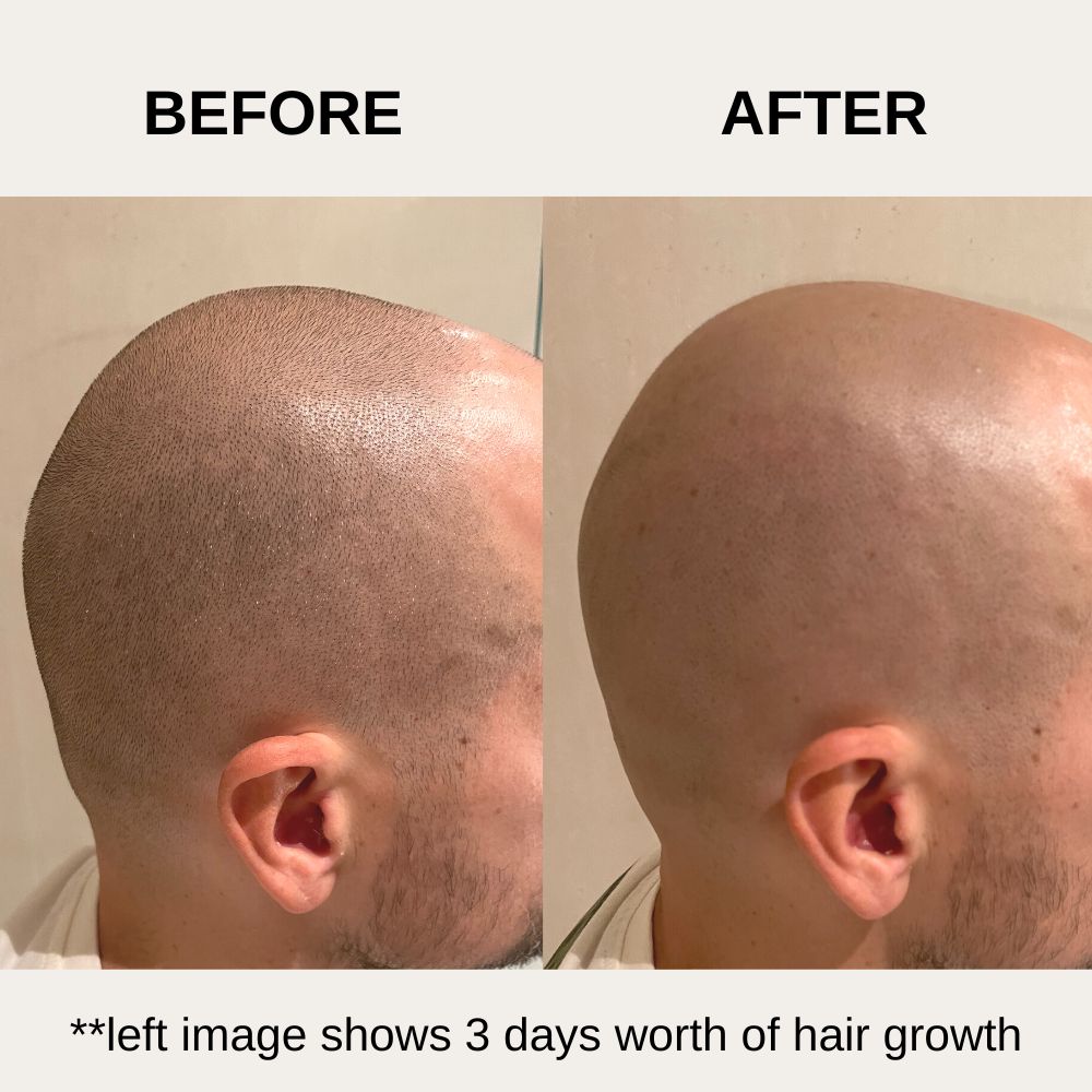Clean Cut Head Shaving Bundle | Electric Head Shaver | Skincare Set | Skull Shaver For Bald Men